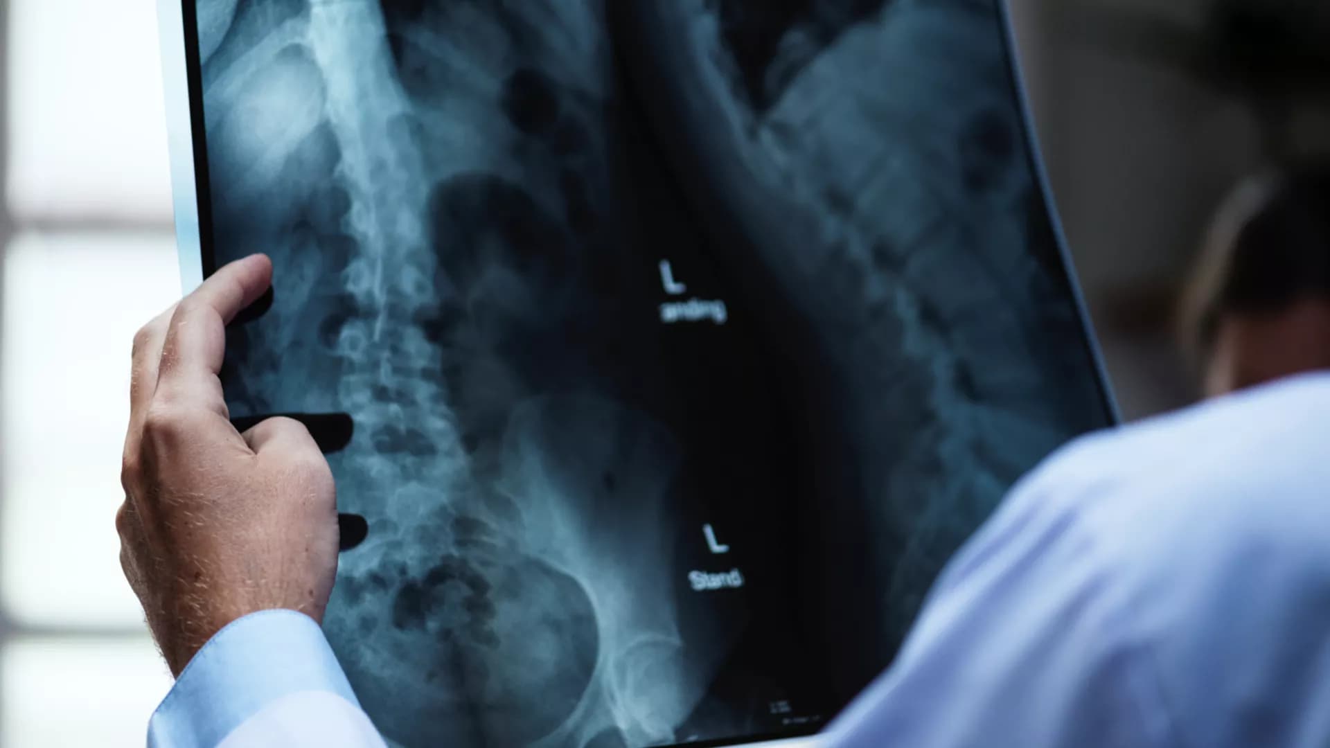 4 ท่า X-ray กระดูกสันหลังส่วนเอว ที่แพทย์ใช้ตรวจเพื่อการวินิจฉัยที่แม่นยำ